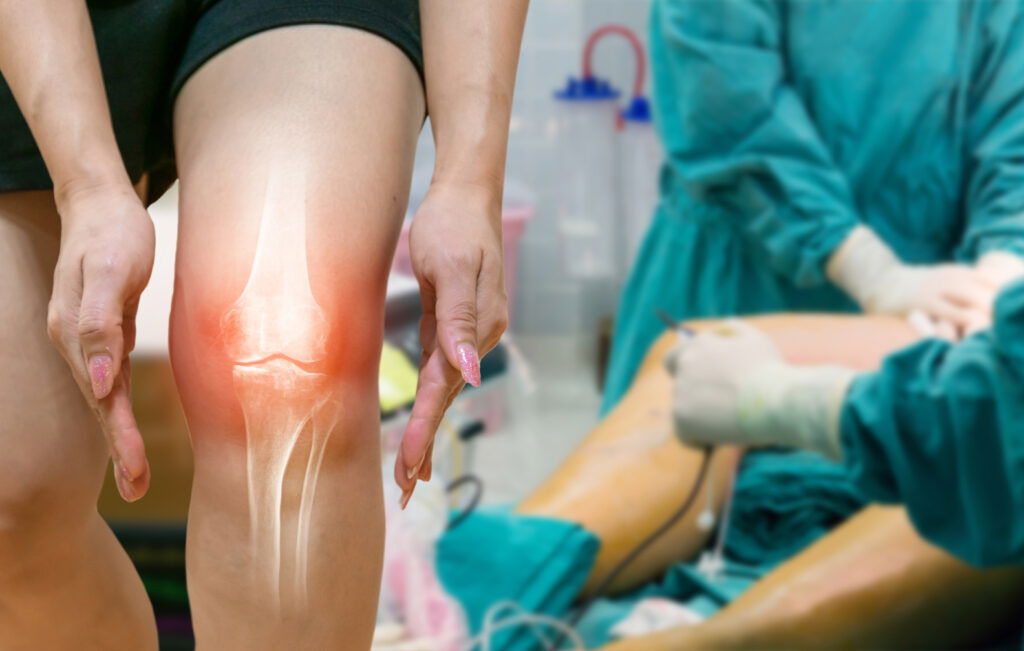 Best Hospital for Total Knee Replacement in Ghaziabad
