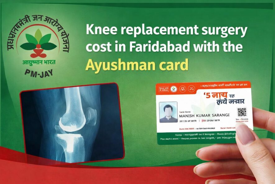 Knee replacement surgery cost