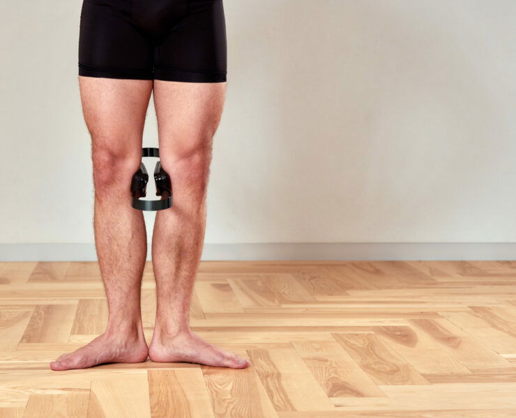 How to Correct Bow Legs in Adults