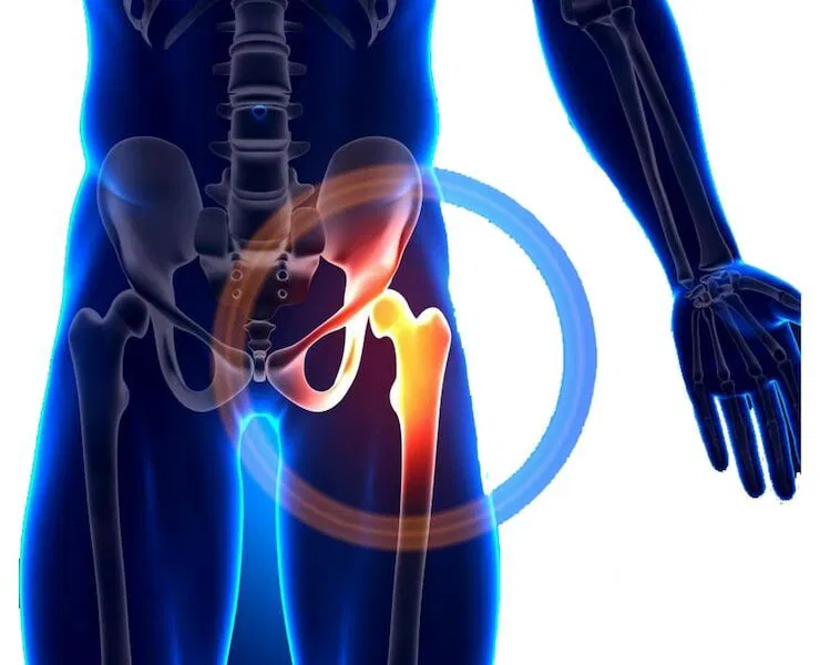 Ball and Socket Joint
