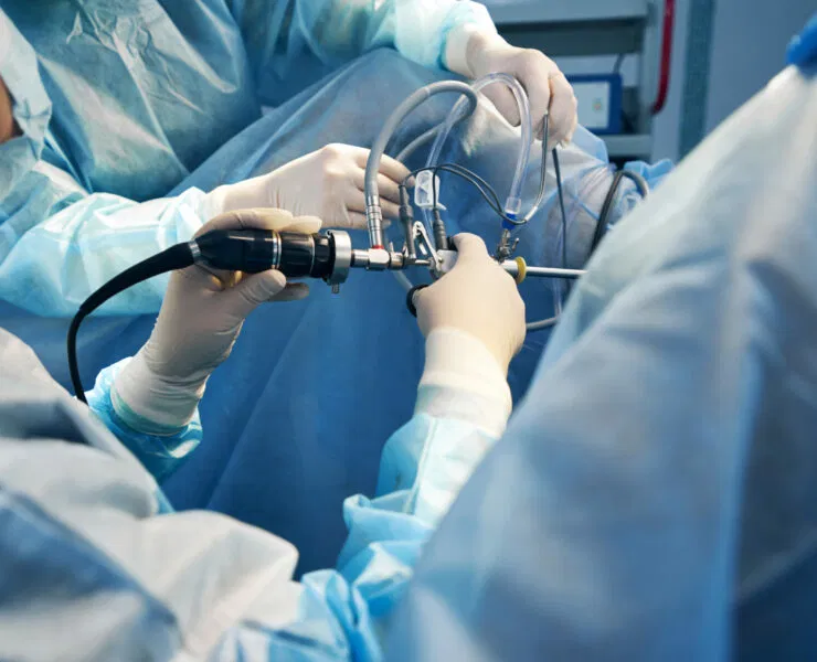 Gallbladder Stone Surgery