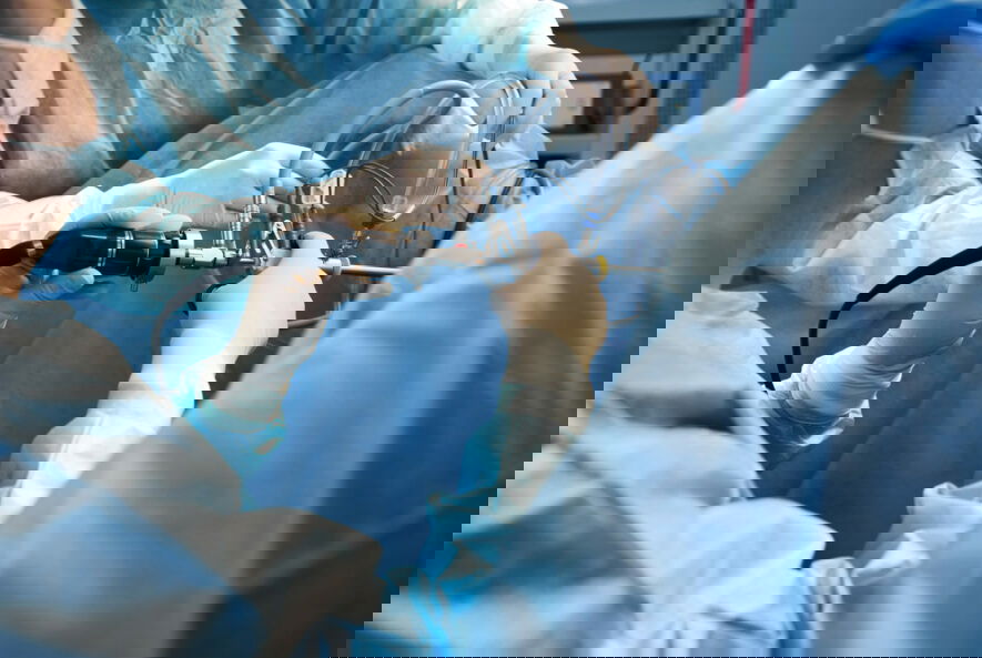 Gallbladder Stone Surgery