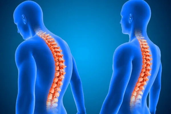 Spine Surgery in Ghaziabad